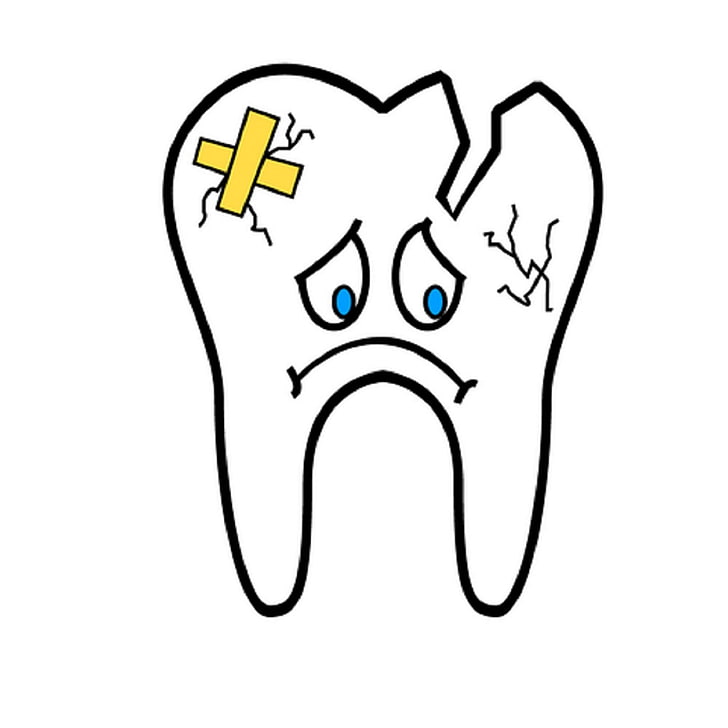 broken tooth, dental, dentist, dentistry, health, oral health, HD wallpaper