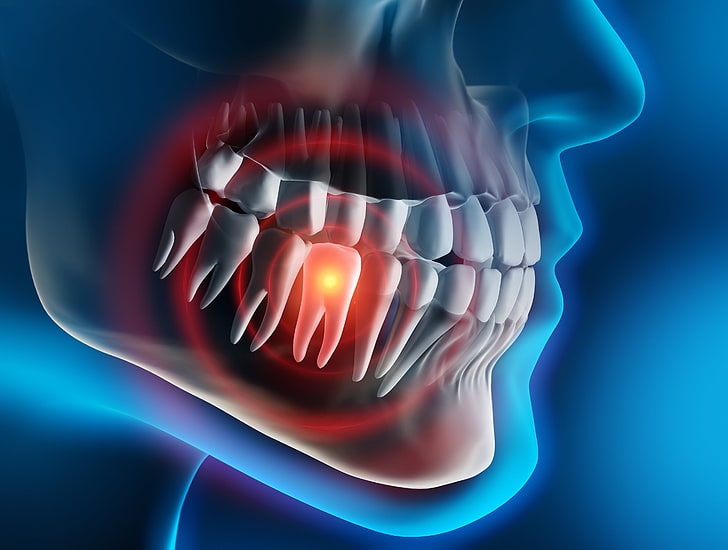 Experiences of unknown dental implants - survey | British Dental Journal
