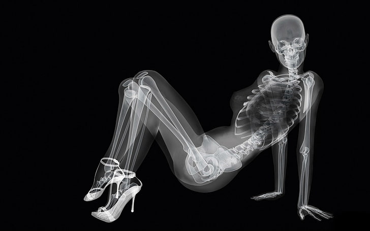 X-ray illustration, girl, skeleton, anatomy, x-ray Image, human Skeleton