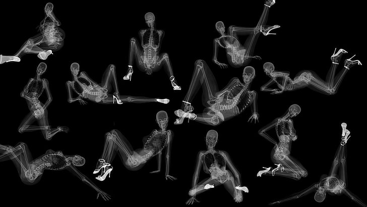 whole body x-ray illustration, style, girls, people, healthcare And Medicine, HD wallpaper