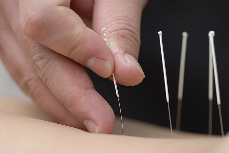 hands, skin, fingers, needles, acupuncture, HD wallpaper