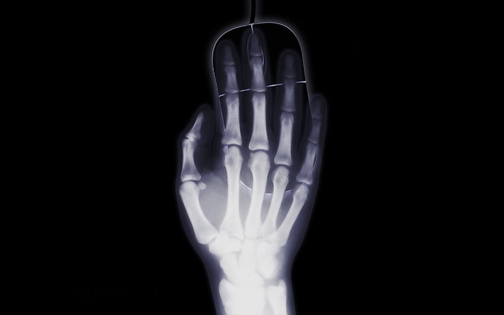 human hand X-ray illustration, Photography, Black, Bones, Humor